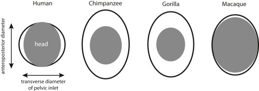 Obstetrical Dilemma illustration